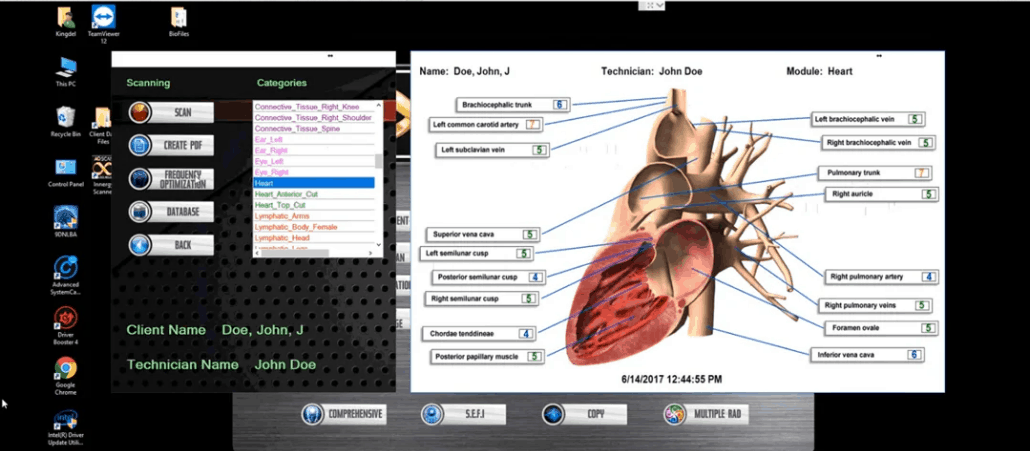 AO Scan Digital Body Analyzer